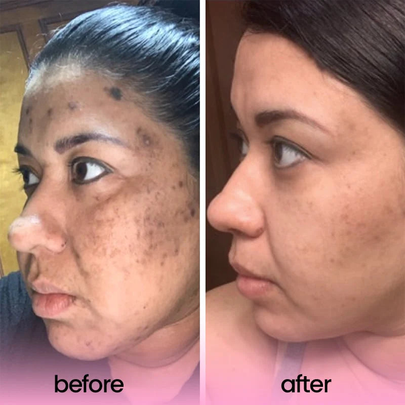 Turmeric Acid Cleaning Pads (Original)