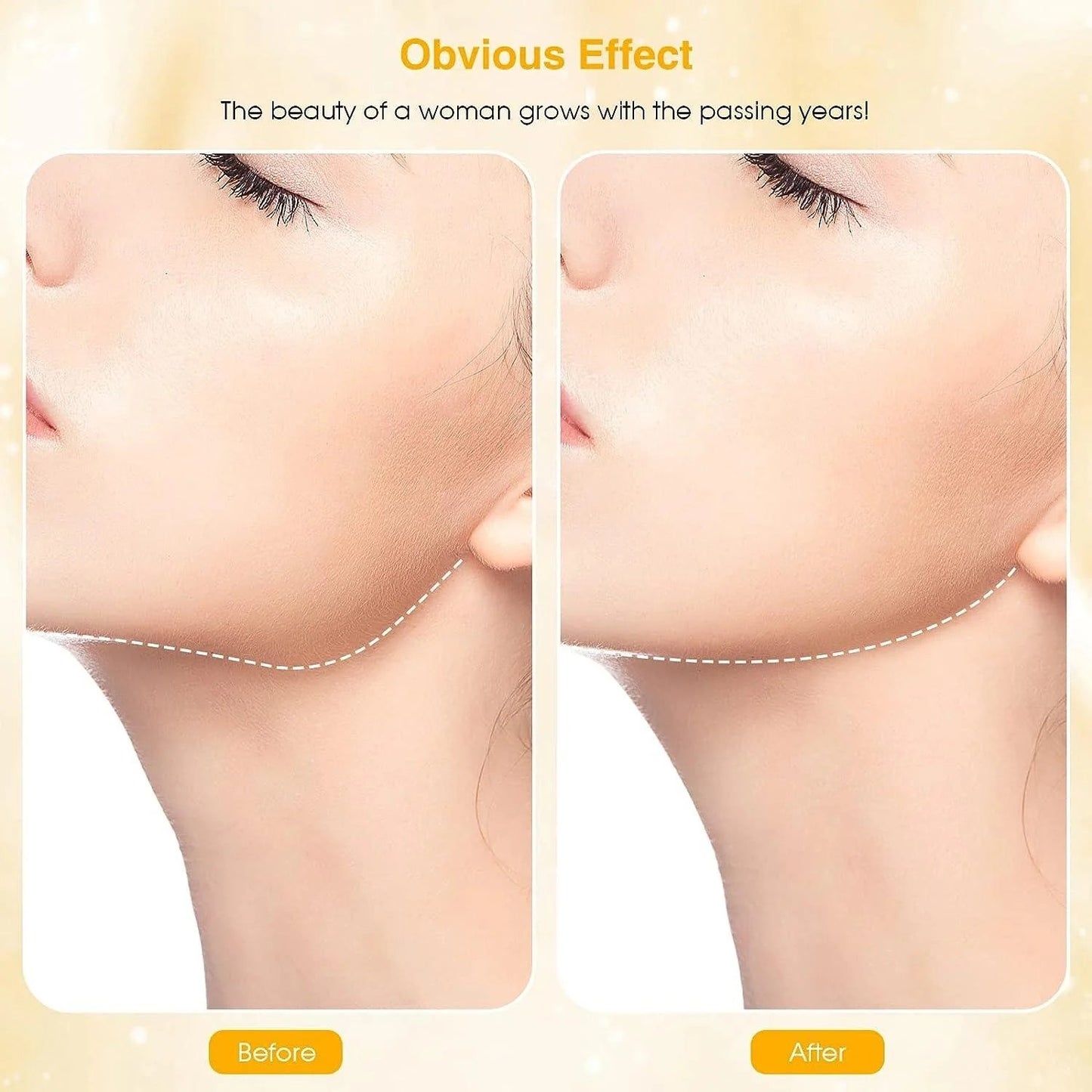 Anti Wrinkle Beauty Apparatus