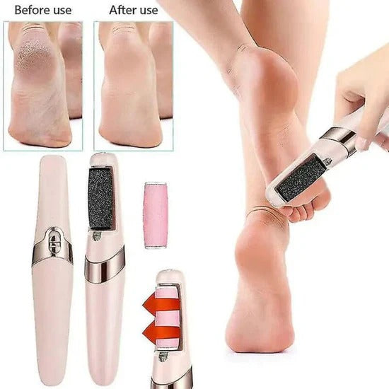 Electric Pedicure Foot File Callus Remover