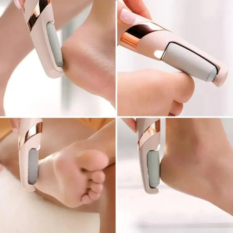 Electric Pedicure Foot File Callus Remover