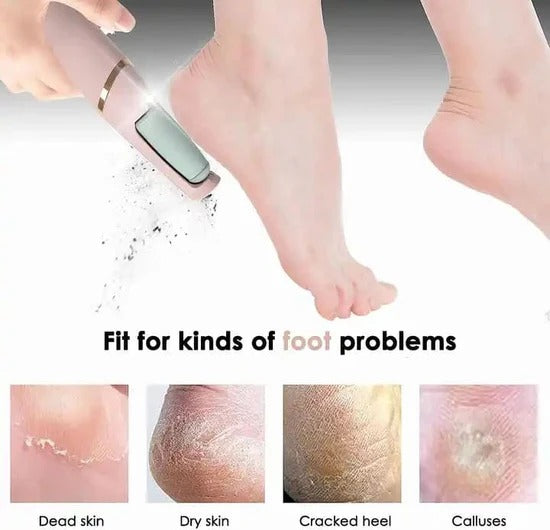 Electric Pedicure Foot File Callus Remover